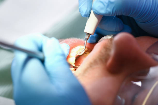 Best Emergency Gum Pain Relief  in Fairchance, PA